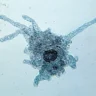 19 Dead In Kerala ! What Is Brain-Eating Amoeba